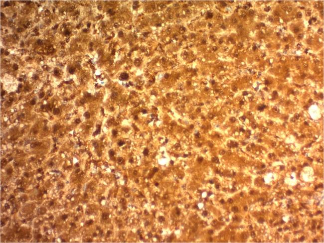 Arginase1 (Hepatocellular Carcinoma Marker) Antibody in Immunohistochemistry (Paraffin) (IHC (P))