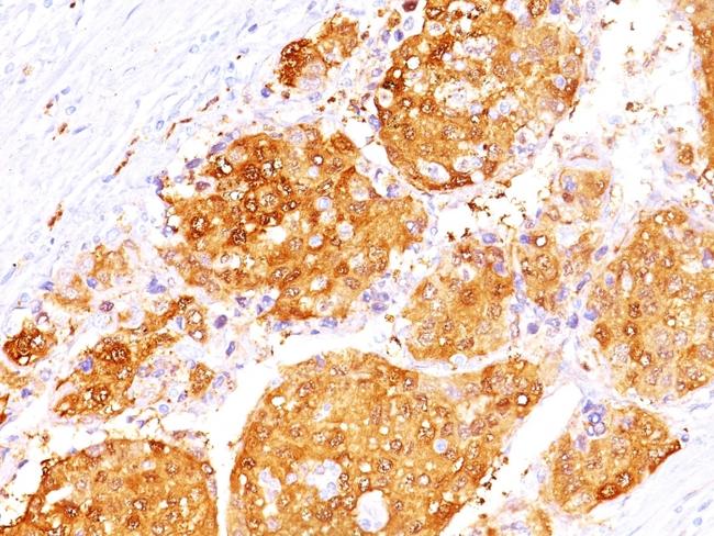 Arginase 1 (Hepatocellular Carcinoma Marker) Antibody in Immunohistochemistry (Paraffin) (IHC (P))