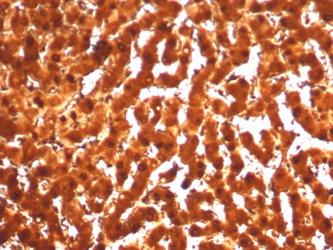 Arginase 1 (Hepatocellular Carcinoma Marker) Antibody in Immunohistochemistry (Paraffin) (IHC (P))