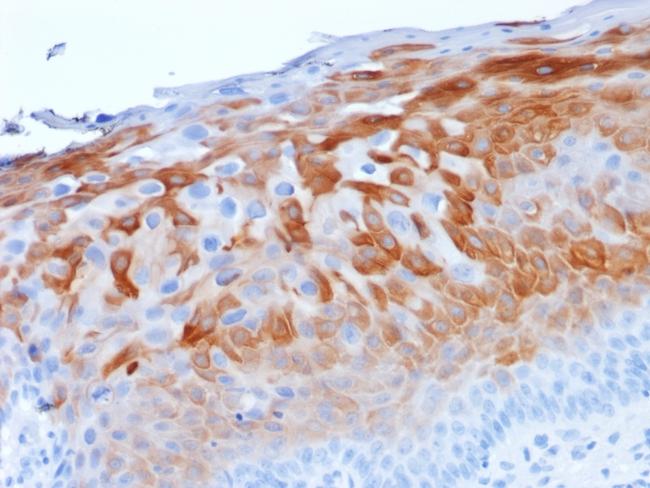 Cytokeratin 1 (Suprabasal Keratinocyte Marker) Antibody in Immunohistochemistry (Paraffin) (IHC (P))