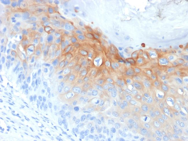 Cytokeratin 1 (Suprabasal Keratinocyte Marker) Antibody in Immunohistochemistry (Paraffin) (IHC (P))