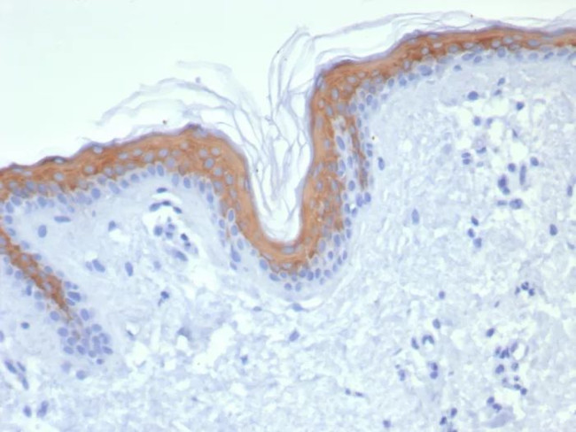 Cytokeratin 1 (Suprabasal Keratinocyte Marker) Antibody in Immunohistochemistry (Paraffin) (IHC (P))