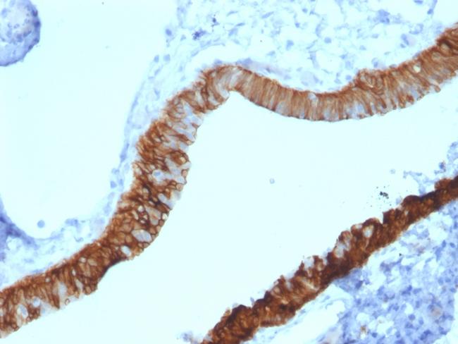 Cytokeratin 3 (KRT3) (Corneal Epithelial Marker) Antibody in Immunohistochemistry (Paraffin) (IHC (P))