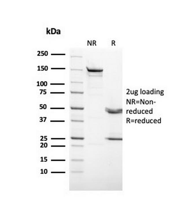 Cytokeratin 3 (KRT3) (Corneal Epithelial Marker) Antibody in SDS-PAGE (SDS-PAGE)