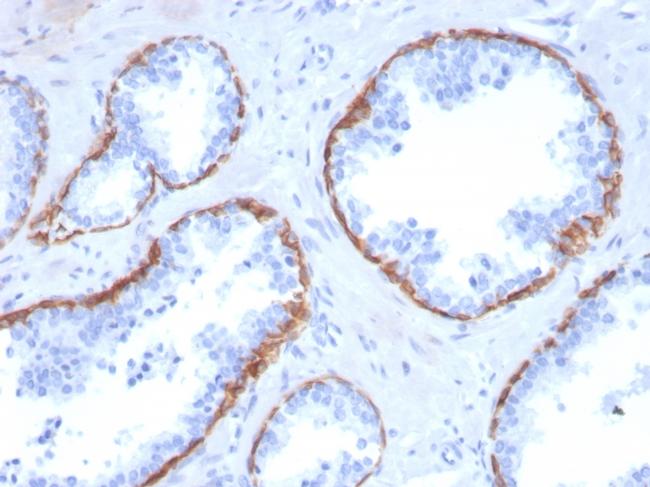 Cytokeratin 5 (KRT5) Antibody in Immunohistochemistry (Paraffin) (IHC (P))