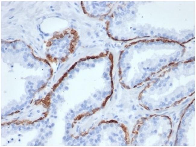 Cytokeratin 5 (KRT5) (Basal, Myoepithelial and MesothelialCellMarker) Antibody in Immunohistochemistry (Paraffin) (IHC (P))