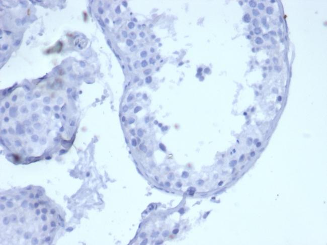 Cytokeratin 5 (KRT5) Antibody in Immunohistochemistry (Paraffin) (IHC (P))