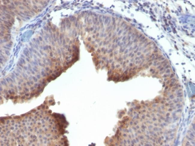 Cytokeratin 6 (KRT6) (Hyperproliferation-Related Keratin) Antibody in Immunohistochemistry (Paraffin) (IHC (P))