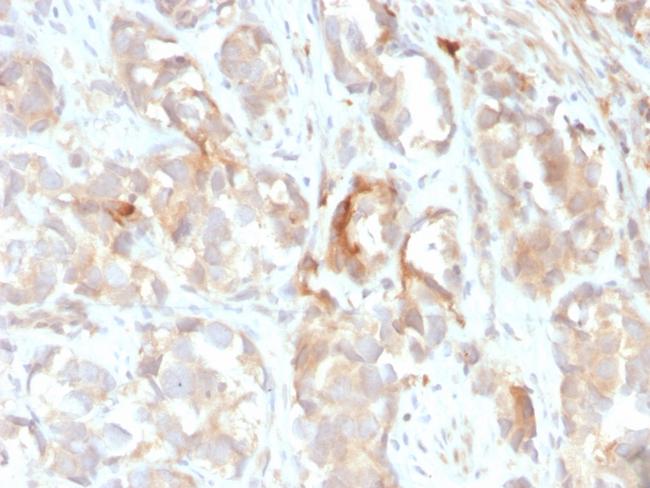 Cytokeratin 6B (KRT6B) (Basal Cell Marker) Antibody in Immunohistochemistry (Paraffin) (IHC (P))