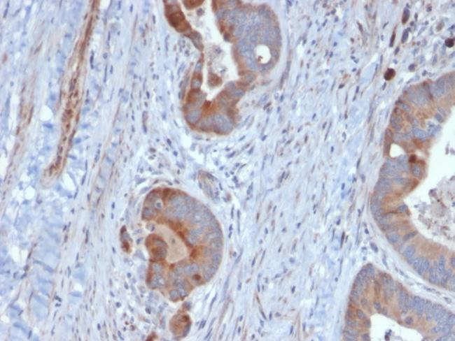 Cytokeratin 6B (KRT6B) (Basal Cell Marker) Antibody in Immunohistochemistry (Paraffin) (IHC (P))