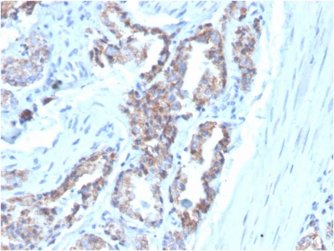 Cytokeratin 7 (Glandular and Transitional Epithelial Marker) Antibody in Immunohistochemistry (Paraffin) (IHC (P))