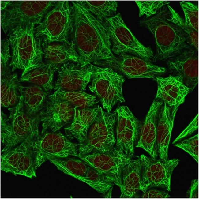 Cytokeratin 7 (Glandular and Transitional Epithelial Marker) Antibody in Immunocytochemistry (ICC/IF)