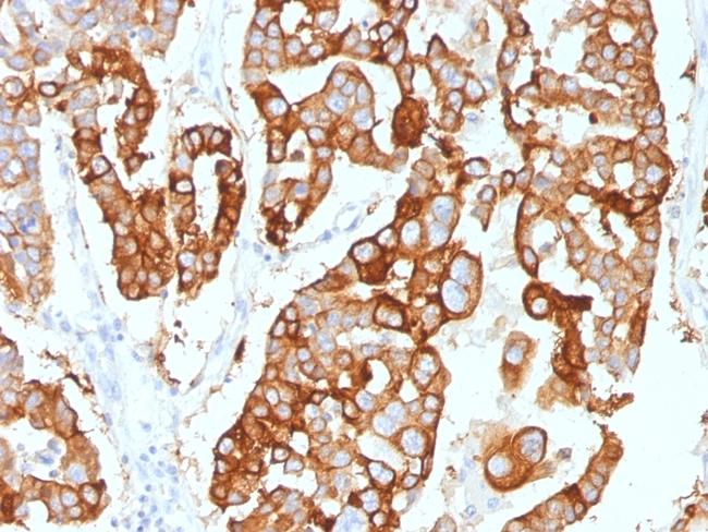 Cytokeratin 7 (Glandular and Transitional Epithelial Marker) Antibody in Immunohistochemistry (Paraffin) (IHC (P))