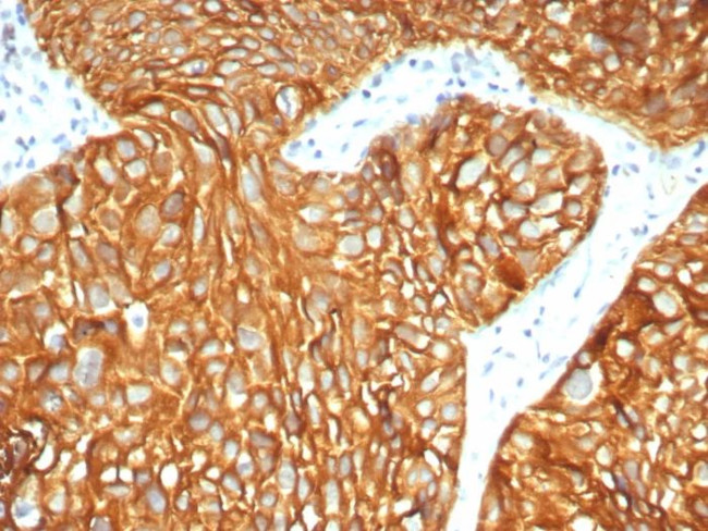 Cytokeratin 7 (Glandular and Transitional Epithelial Marker) Antibody in Immunohistochemistry (Paraffin) (IHC (P))