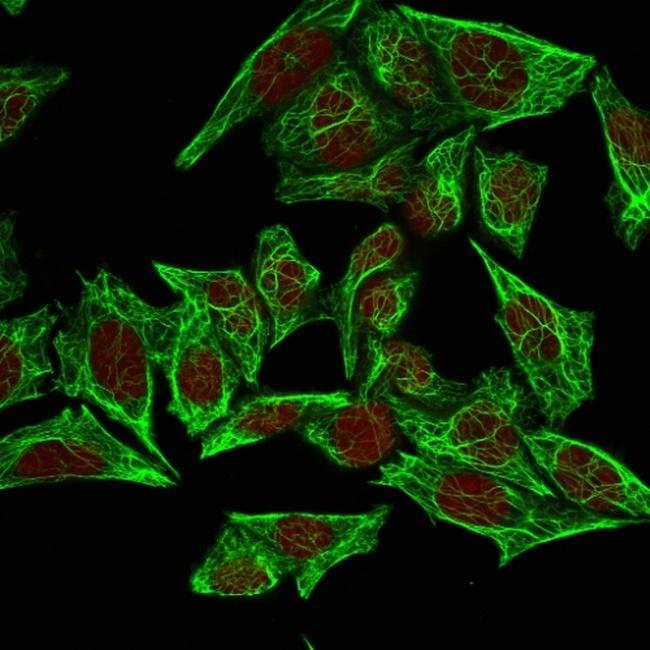 Cytokeratin 7 (Glandular and Transitional Epithelial Marker) Antibody in Immunocytochemistry (ICC/IF)