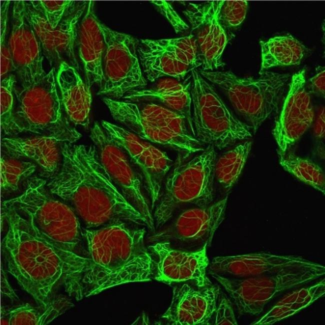 Cytokeratin 7 (Glandular and Transitional Epithelial Marker) Antibody in Immunocytochemistry (ICC/IF)