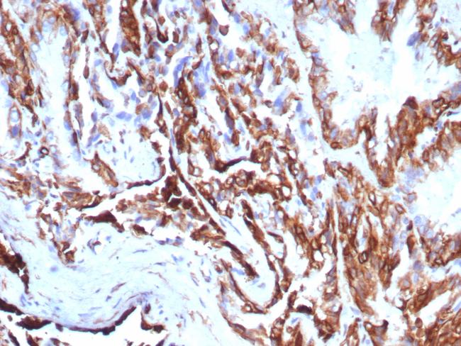 Cytokeratin 7 (Glandular and Transitional Epithelial Marker) Antibody in Immunohistochemistry (Paraffin) (IHC (P))