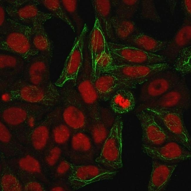 Cytokeratin 7 (Glandular and Transitional Epithelial Marker) Antibody in Immunocytochemistry (ICC/IF)