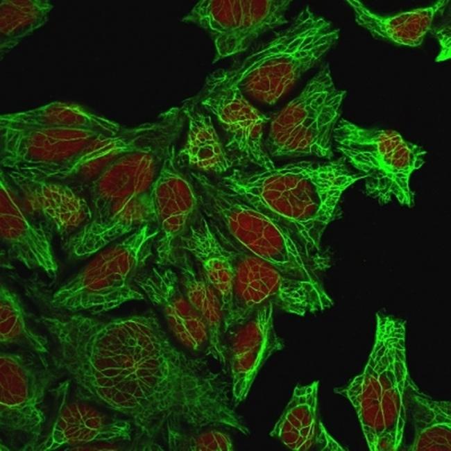 Cytokeratin 7 (Glandular and Transitional Epithelial Marker) Antibody in Immunocytochemistry (ICC/IF)