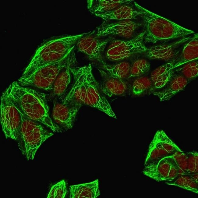 Cytokeratin 7 (Glandular and Transitional Epithelial Marker) Antibody in Immunocytochemistry (ICC/IF)