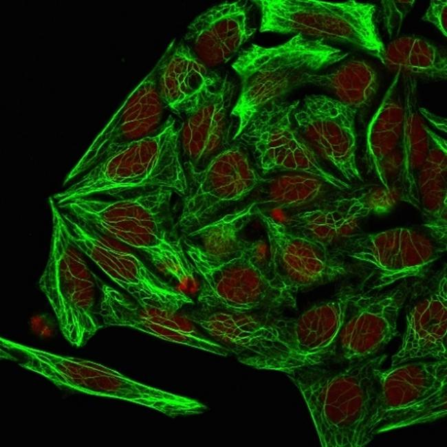 Cytokeratin 7 (Glandular and Transitional Epithelial Marker) Antibody in Immunocytochemistry (ICC/IF)