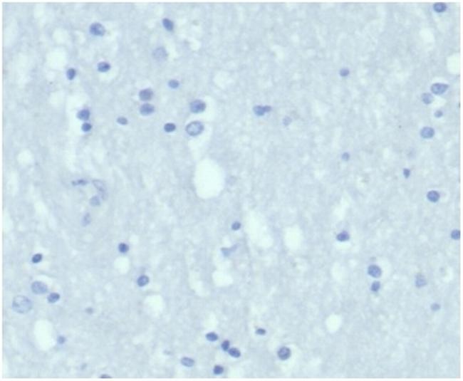 Cytokeratin 7 (Glandular and Transitional Epithelial Marker) Antibody in Immunohistochemistry (Paraffin) (IHC (P))