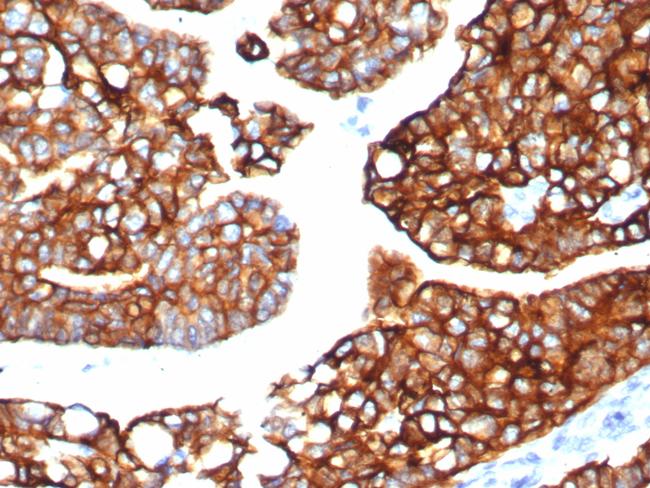 Cytokeratin 7 (Glandular and Transitional Epithelial Marker) Antibody in Immunohistochemistry (Paraffin) (IHC (P))