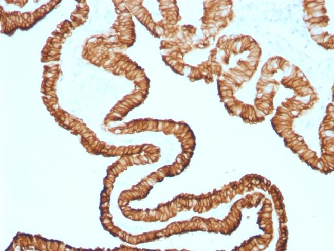 Cytokeratin 7 (Glandular and Transitional Epithelial Marker) Antibody in Immunohistochemistry (Paraffin) (IHC (P))