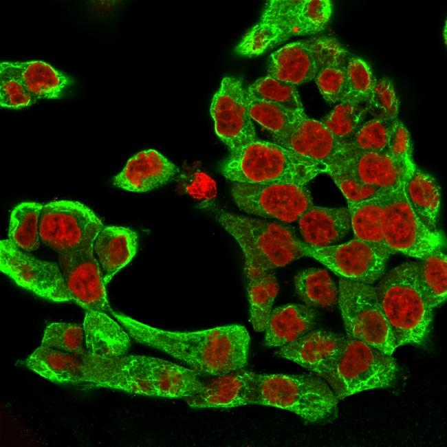 Cytokeratin 8 (KRT8) Antibody in Immunocytochemistry (ICC/IF)