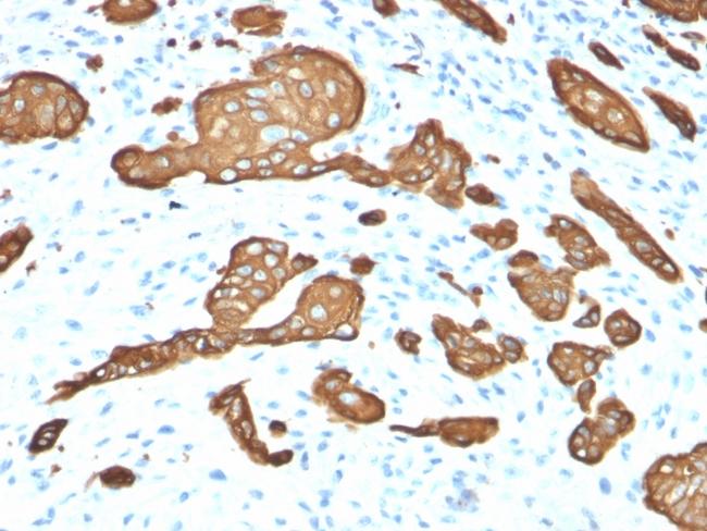 Cytokeratin 8 (KRT8) Antibody in Immunohistochemistry (Paraffin) (IHC (P))