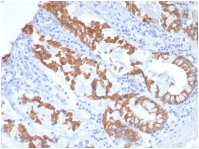 Cytokeratin 8 (KRT8) Antibody in Immunohistochemistry (Paraffin) (IHC (P))