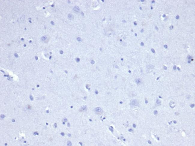 Cytokeratin 8 (KRT8) Antibody in Immunohistochemistry (Paraffin) (IHC (P))