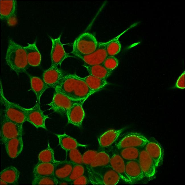 Cytokeratin 8 (KRT8) Antibody in Immunocytochemistry (ICC/IF)