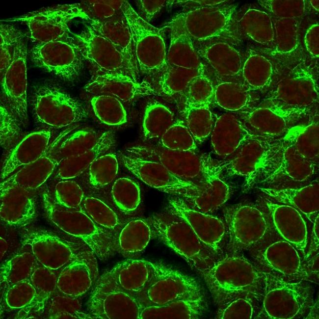 Cytokeratin 8 (KRT8) Antibody in Immunocytochemistry (ICC/IF)