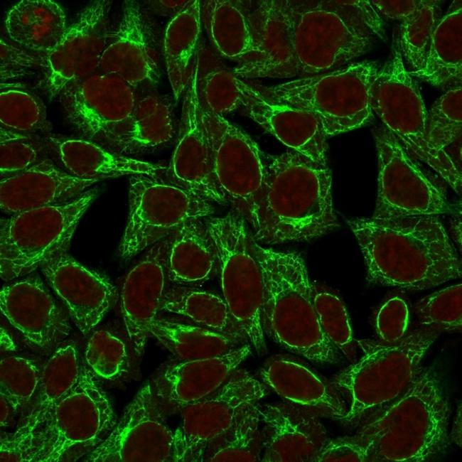 Cytokeratin 8 (KRT8) Antibody in Immunocytochemistry (ICC/IF)