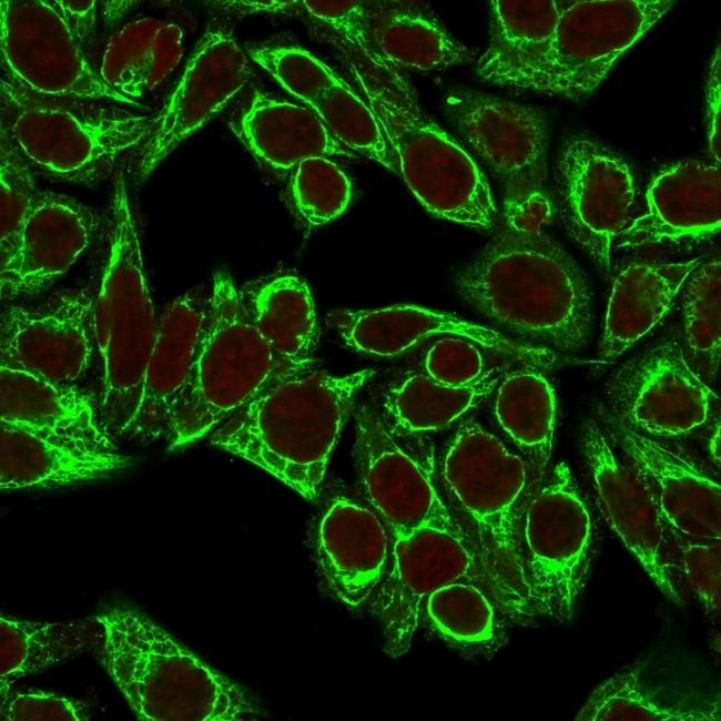 Cytokeratin 8 (KRT8) Antibody in Immunocytochemistry (ICC/IF)