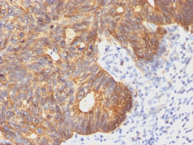 Cytokeratin 8 (KRT8) Antibody in Immunohistochemistry (Paraffin) (IHC (P))