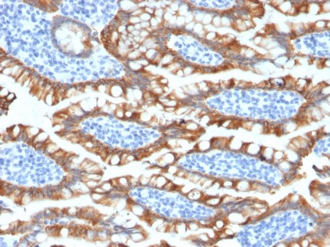 Cytokeratin 8 (KRT8) Antibody in Immunohistochemistry (Paraffin) (IHC (P))