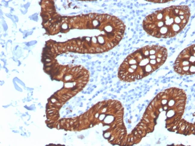 Cytokeratin 8 (KRT8) Antibody in Immunohistochemistry (Paraffin) (IHC (P))