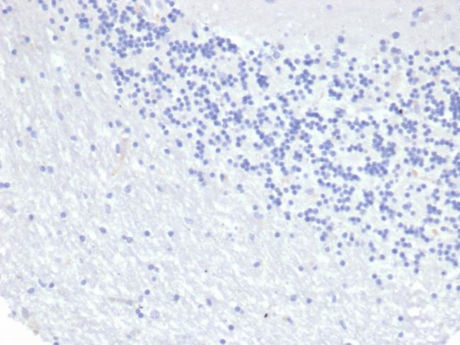 Cytokeratin 8 (KRT8) Antibody in Immunohistochemistry (Paraffin) (IHC (P))