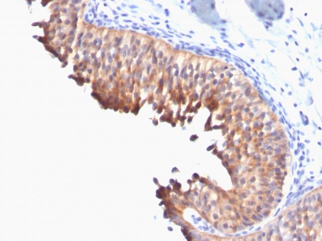 Cytokeratin 10 (Suprabasal Epithelial Marker) Antibody in Immunohistochemistry (Paraffin) (IHC (P))