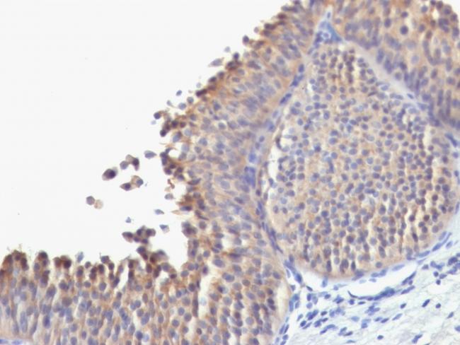 Cytokeratin 10 (Suprabasal Epithelial Marker) Antibody in Immunohistochemistry (Paraffin) (IHC (P))