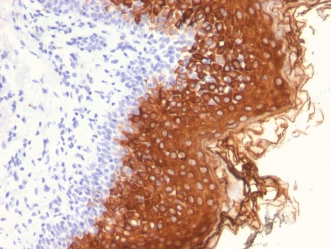 Cytokeratin 10 (Suprabasal Epithelial Marker) Antibody in Immunohistochemistry (Paraffin) (IHC (P))