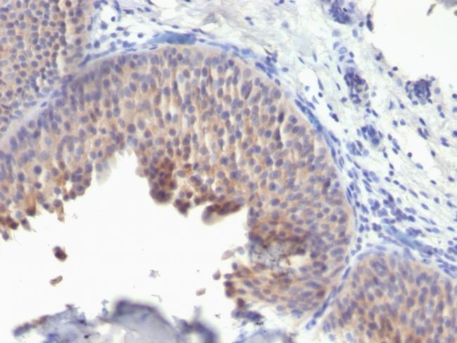 Cytokeratin 10 (Suprabasal Epithelial Marker) Antibody in Immunohistochemistry (Paraffin) (IHC (P))