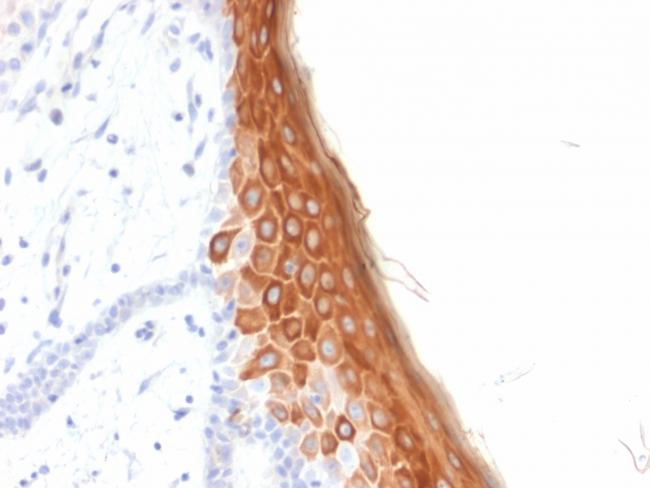 Cytokeratin 10 (KRT10) (Suprabasal Epithelial Marker) Antibody in Immunohistochemistry (Paraffin) (IHC (P))