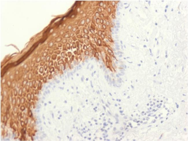 Cytokeratin 10 Antibody in Immunohistochemistry (Paraffin) (IHC (P))