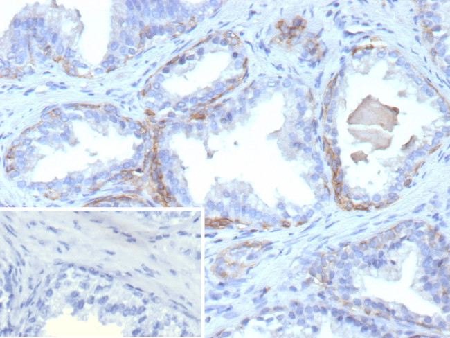 Cytokeratin 13 (Non-Keratinized Squamous Epithelial Marker) Antibody in Immunohistochemistry (Paraffin) (IHC (P))