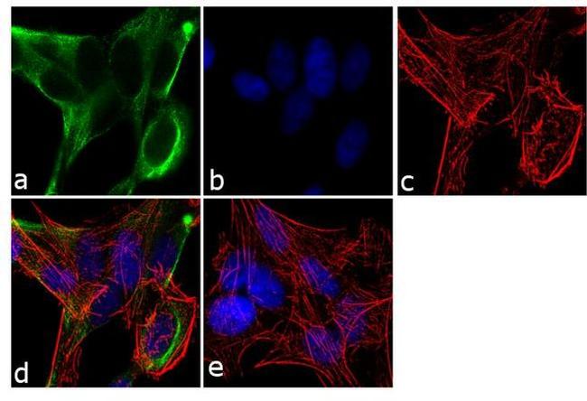 BMPR1A Antibody in Immunocytochemistry (ICC/IF)