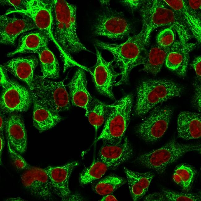 Cytokeratin 14 (KRT14) (Squamous Cell Marker) Antibody in Immunocytochemistry (ICC/IF)