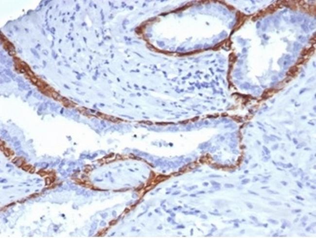 Cytokeratin 14 (KRT14) (Squamous Cell Marker) Antibody in Immunohistochemistry (Paraffin) (IHC (P))